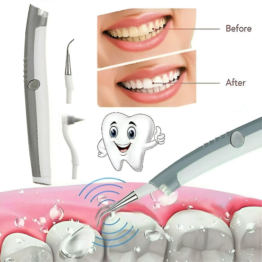 ULTRASONIC ELECTRIC TOOTH DENTAL cleaner with led light